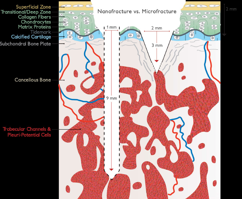 row-2-hcp-carti-nano