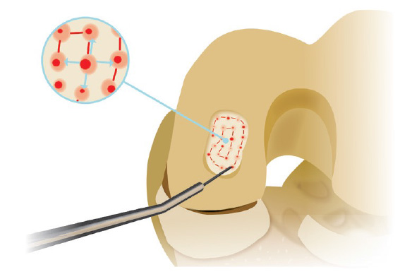 row-6-hcp-carti-nano